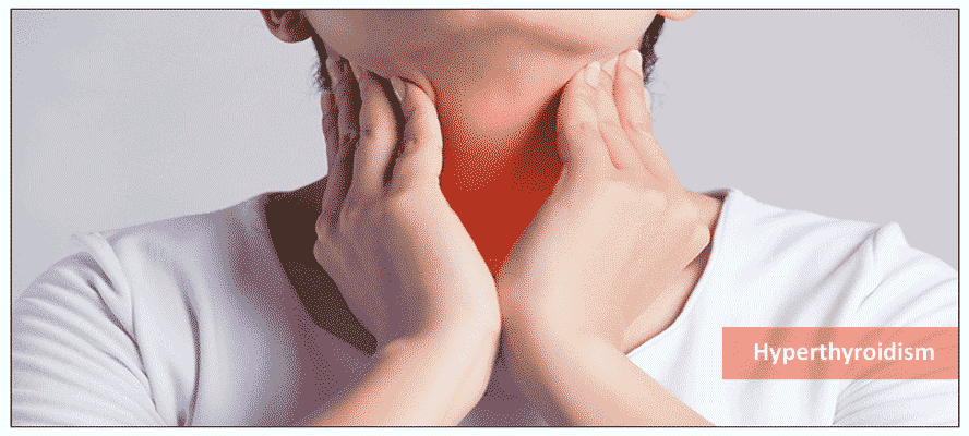 Know More About Hyperthyroidism
