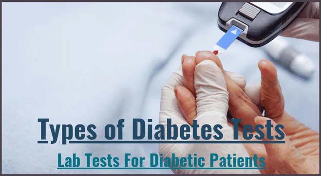 Types of Diabetes Tests: Explore List of Lab Tests For Diabetes Patients
